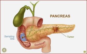 Pin On Enfermedades