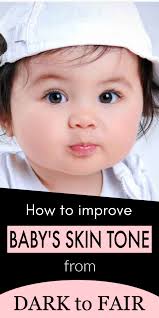 Improve Your Baby S Skin Tone Dark To Fair With This Home Remedy In Just 10 Days Fairskin Skin In 2020 Kids Skin Care Improve Skin Complexion Skin Care Home Remedies