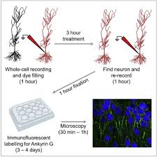 Animal cell structure label figure 4.2. Repeated Whole Cell Patch Clamp Recording From Ca1 Pyramidal Cells In Rodent Hippocampal Slices Followed By Axon Initial Segment Labeling Sciencedirect