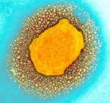 That outbreak was traced to pet prairie dogs in the midwest that. Elisa For Monkeypox