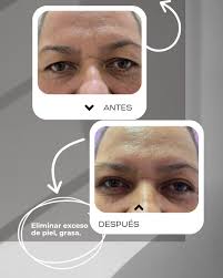 Carlos Ricardo Contreras Ceja (@dr.ricardo.contreras) · Apatzingan