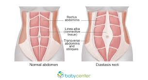 Human body muscles stomach muscles chest muscles core muscles lower back muscles anatomy abdominal muscles anatomy body muscle chart muscle diagram shoulder muscle anatomy. Diastasis Recti Babycenter