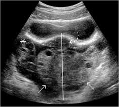 Focus on scanning your patient without wires getting in the way Ovarian Torsion Developing A Machine Learned Algorithm For Diagnosis Springerlink