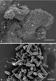 How listeria monocytogenes is transmitted. Scanning Electron Microscopy Images Of Listeria Monocytogenes Download Scientific Diagram