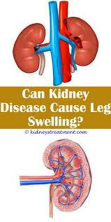 Kidney Disease Link Polycystic Kidney Disease Kidney Transplant Kidney Disease Symptoms