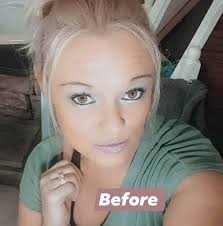 Escaping a narcissistic relationship improves mental health greatly