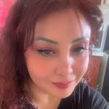 Tengo una masa en el ojo La pinguécula es un tumor benigno en la  conjuntiva, es decir, un pequeño bulto que se suele formar en la superficie  del globo ocular cerca de