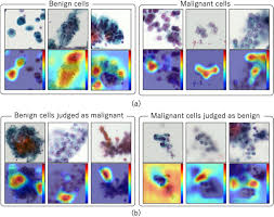 Automated Classification Of Benign And Malignant Cells From Lung Cytological Images Using Deep Convolutional Neural Network Sciencedirect