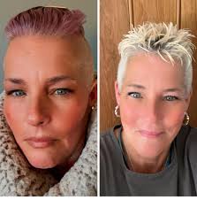 Black is everyone's favourite colour until it comes to skin colour