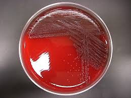 Image result for yersinia fotos