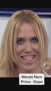 How’s that even possible? 😳 #dental #surgery