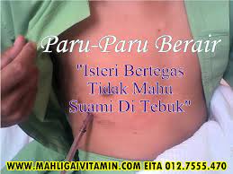 Tbc.asma.sembuh 100% dengan ( minyak herbal jum 1000 ) sudah tersedia di tokopedia.bukalapak.shopee.salam sehat kita semua. Paru Paru Berair Isteri Bertegas Tidak Mahu Suami Di Tebuk