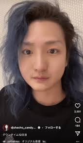 — dj社長【レペゼン地球】の中の人 (@dj_shacho2) january 22, 2018. Djç¤¾é•· æ•´å½¢12æ—¥ç›® ã®å¤‰åŒ–ã«åéŸ¿ å'äº•ç†ä¼¼ ç›®ãŒã‚¬ãƒƒã‚­ãƒ¼ æ—¥åˆŠå¤§è¡†