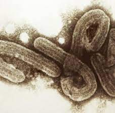 Aug 10, 2021 · deadly marburg virus case reported for first time in west africa. Infektionskrankheiten Touristin Stirbt An Gefahrlichem Marburg Virus Welt