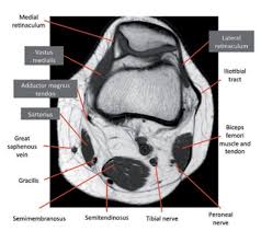 Knowledge of the anatomy and patterns of injury of these structures is crucial for early and correct diagnosis by clinical examination and magnetic resonance ( . Knee Springerlink