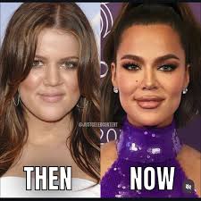 Sza was gorgeous before....