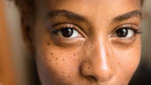Skin cancer foundation a normal mole is shown in this picture. Signs Of Skin Cancer This Skin Check Can Save Your Life Glamour