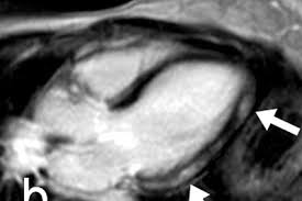 Eine mrt brachte erst die genaue diagnose. Radiologie In Der Herzdiagnostik Raus Aus Den Kinderschuhen Management Krankenhaus