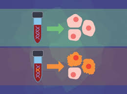 For example, breast cancer that has spread to the lungs is still breast cancer, not lung cancer. Personalized Blood Biopsies Demonstrate Potential As Early Warning Signal Of Breast Cancer Recurrence Broad Institute