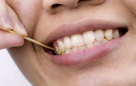 See full list on wikihow.com Ask The Dentist Trapped Food Can Be Awkward To Remove Unless You Have A Flip Top Head The Irish News