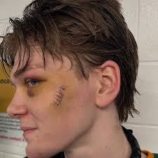 Chicks dig scars. What a hockey player. @hockepayne