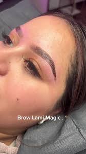 Gum Contouring Tulsa Oklahoma