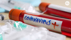 Maybe you would like to learn more about one of these? Covid 19 Vaccine And When Life Will Be Normal Maybe 2021 Fauci Says
