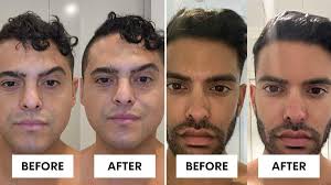 Aussie eczema and psoriasis sufferer launches skincare range for sensitive  skin and shoppers are 'blown away'