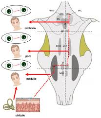 Image result for Oculovestibular Testing