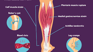 The popliteus muscle, located in the lower leg, is responsible for unlocking the these muscles are sometimes termed the hamstring group. Calf Pain Causes Treatment And When To See A Doctor