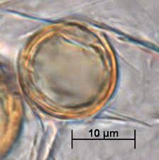 Image result for Micrargeria filiformis