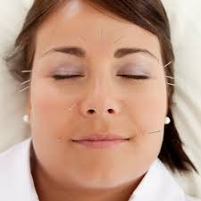 Kelowna Acupuncture & Natural Therapies