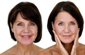 8m likes · 613,593 talking about this. How Much Does A Facelift Cost What Is A Mini Facelift And How Long Does It Last