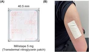Image result for Nitroglycerin Patch