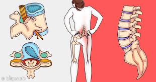 Unlu Cerrah Acikladi Bunlari Yapan Asla Kambur Olmaz Sirt Agrisi Saglik Bel Fitigi