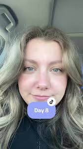 Stephanie Tew Burnham