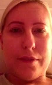 Mum-of-three cruelly dumped by fiance after getting Dynamo 'moonface' due  to debilitating Crohn's disease