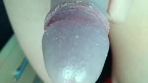 Montrant Smegma sous Foreskin et sale bite malodorante saccadé