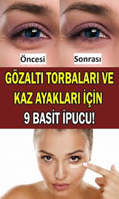 Gozalti Torbalari Ve Kaz Ayaklari Icin Ipuclari Goz Alti Morluklari Ve Kirisikliklari Nasil Gecer Dogal Cilt Bakimi Saglik Dogal Guzellik Ipuclari