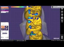 Pin On Dental Cad Design