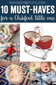 It can range from mild and flexible to severe and rigid. 20 Club Foot Baby Kissy Toes Ideas Club Foot Baby Club Foot Baby