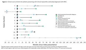 More specifically, it is described as. Myocarditis An Important Presentation Of Arrhythmogenic Right Ventricular Cardiomyopathy Arvc Journal Of Cardiac Failure