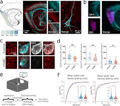 Animal cells do not have chloroplasts, so answer choice (b) is the correct one. Perineuronal Nets Stabilize The Grid Cell Network Nature Communications