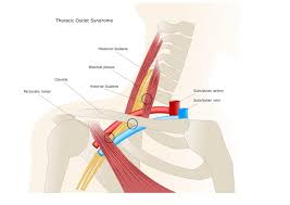 Simple structure of the clavicle. A Pain In The Neck Central Lakes Physio Pilates