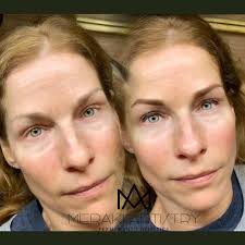 Can't believe what a beautiful young lady she is growing into 😍😍. She  wanted a girly makeover so we had this photoshoot. Can't lie, I was a  little disappointed that after only