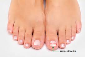 Image result for Onycholysis feet