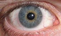 Heterochromia Iridium Skimbleshanks Has Eyes Like This One Central Heterochromia Heterochromia Gray Eyes