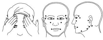 Bells palsy can be treated naturally. Journal Of Acupuncture Research