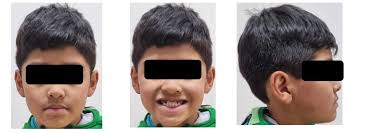 Revista RIIS vol.18-No.44 UNIVALLE by DNI-UNIVALLE