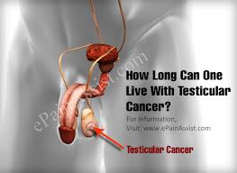 Symptoms, pictures, signs, causes, statistics, prognosis, screening, staging, survival rate and prevention. How Long Can One Live With Testicular Cancer